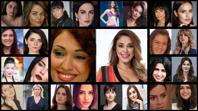 Estetikli Halleriyle Estetik Olmadan Önceki Halleri Arasında Uçurumlar Olan  Ünlü İsimler