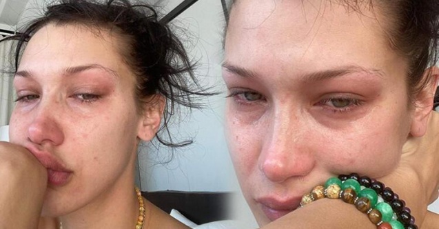 Bella Hadid zor günleri geride bıraktı