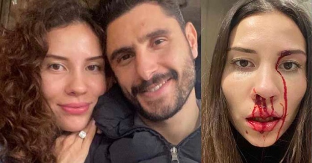 Eşi Özer Hurmacı’dan şiddet gören Mihriban Hurmacı'dan şok sözler!