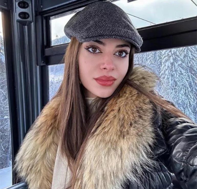 Defne Samyeli'nin kızı Derin Talu sevgilisi tarafından darp mı edildi? Samyeli sessizliğini bozdu