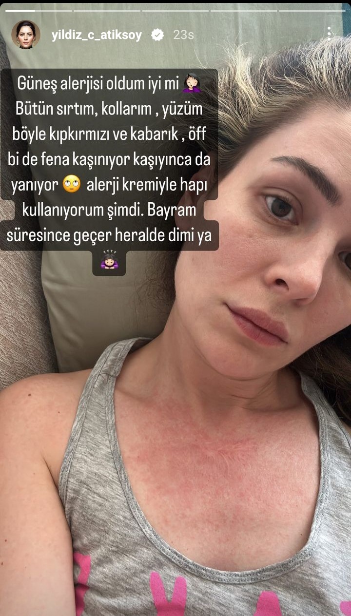 Yıldız Çağrı Atiksoy'dan kötü haber