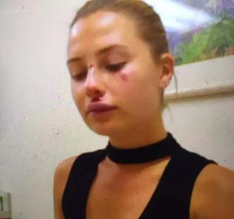 Serdar Ortaç'ın eski eşi Chloe Loughnan sessizliğini bozdu! Olay yaratacak açıklamalar!