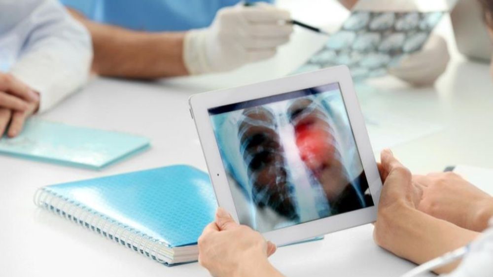 Uzmanı uyardı! Ölümcül akciğer kanseri son yıllarda kadınlarda artış gösterdi