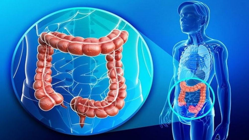Değişen beslenme düzeni kolorektal kanser riskini artırıyor 