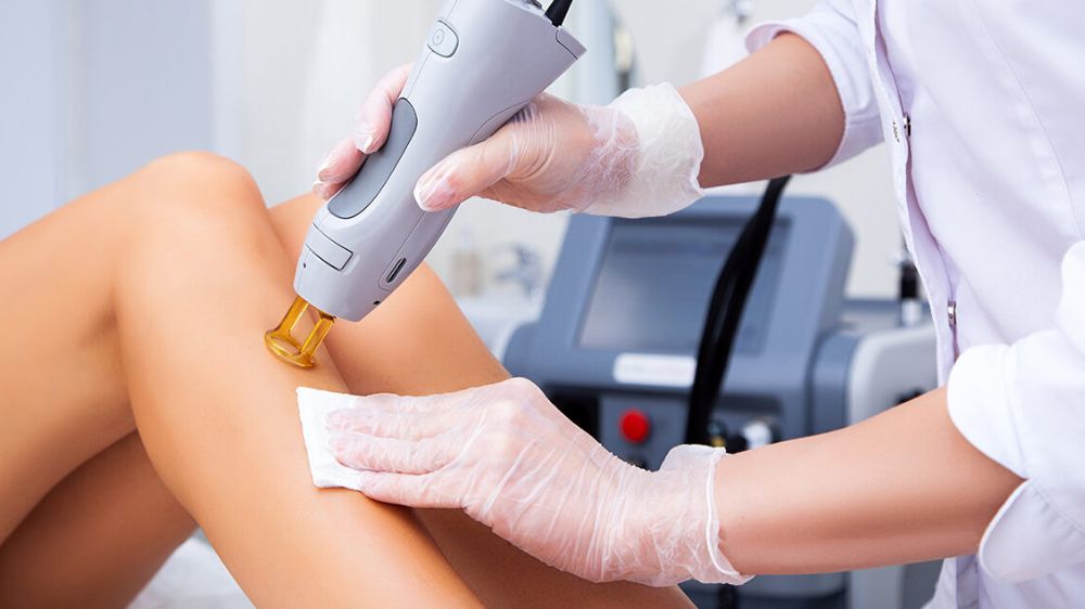 Yaz geldi: Pürüzsüz bir cilt için lazer epilasyon zamanı!