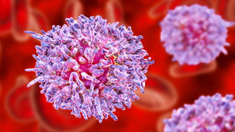 Tüylü hücreli löseminin 11 belirtisine dikkat! 