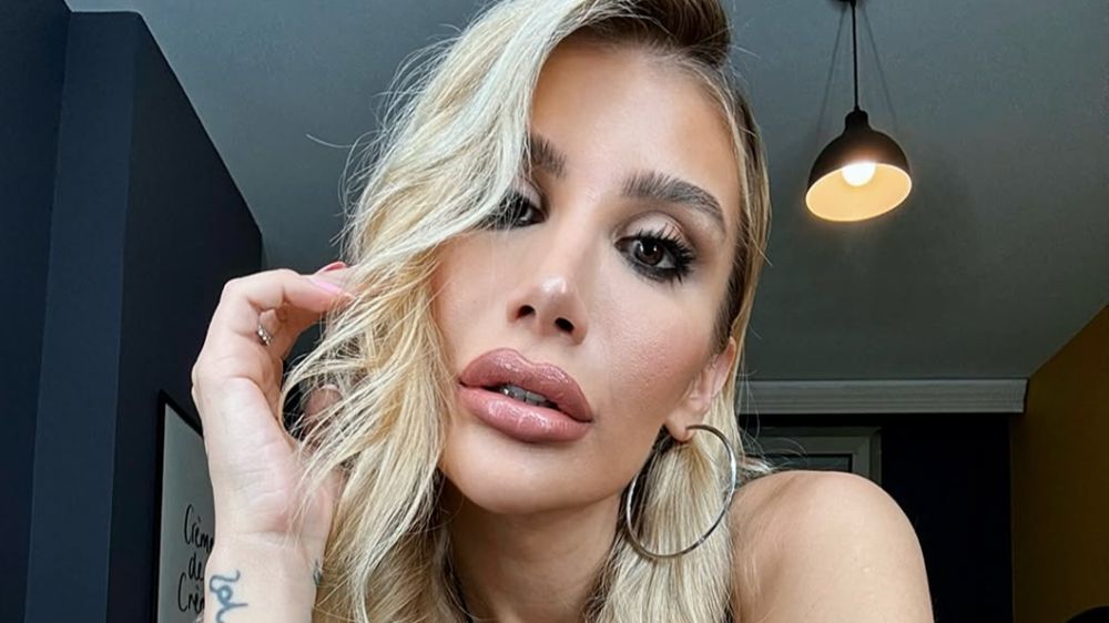 Merdivenden düşen İrem Derici hastanelik oldu!