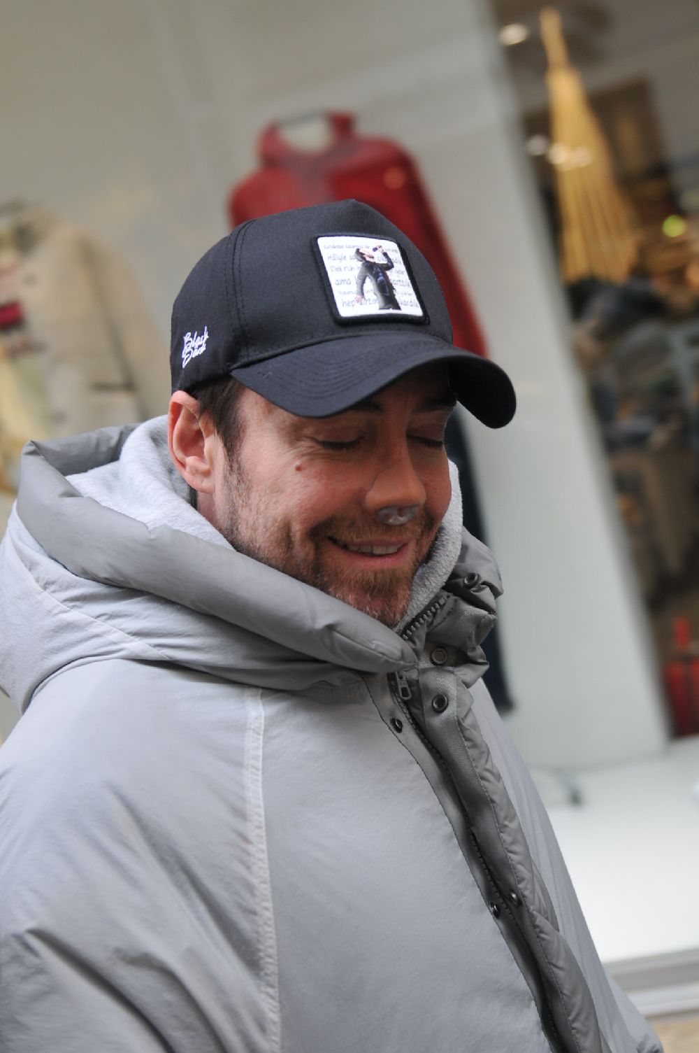 12 kez burun ameliyat olan Murat Dalkılıç, ilk kez süreç hakkında konuştu!