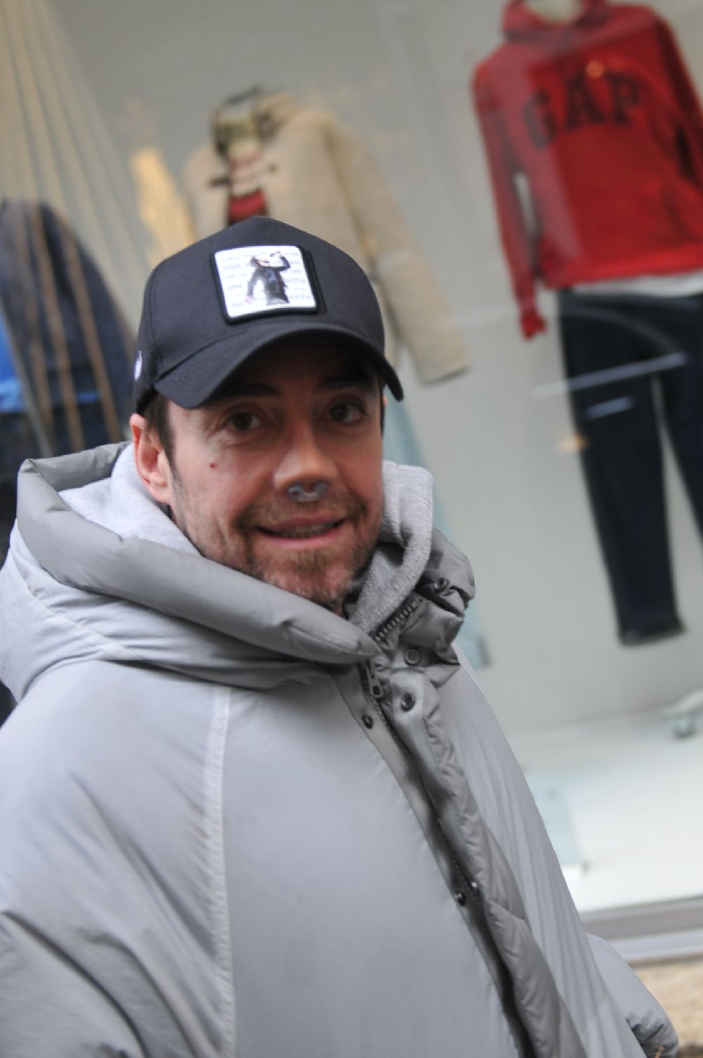 12 kez burun ameliyat olan Murat Dalkılıç, ilk kez süreç hakkında konuştu!