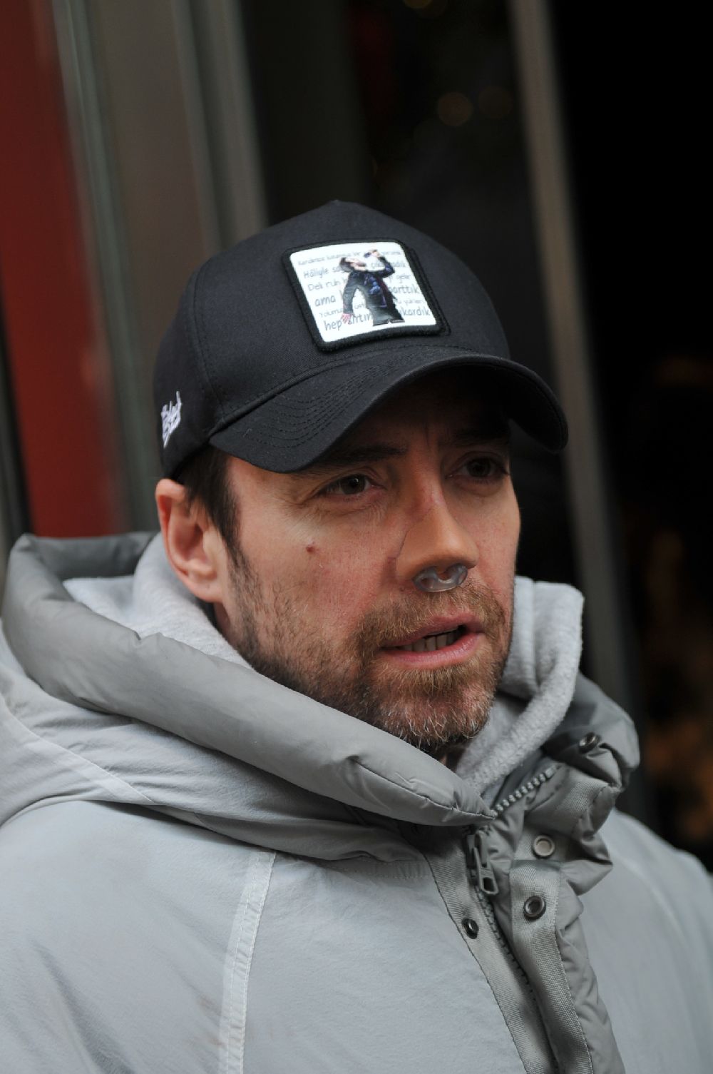 12 kez burun ameliyat olan Murat Dalkılıç, ilk kez süreç hakkında konuştu!