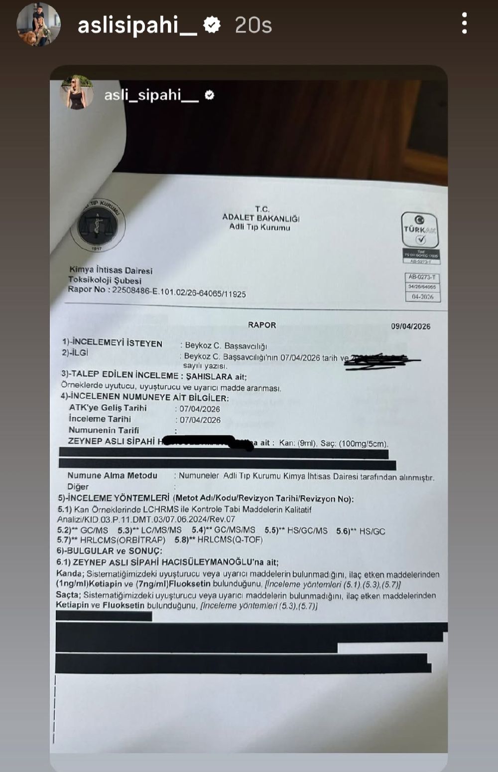 Aslı Sipahi'nin testi negatif çıktı