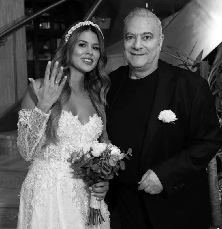 Gülseren Ceylan gözündeki morluğun sebebini açıkladı!   