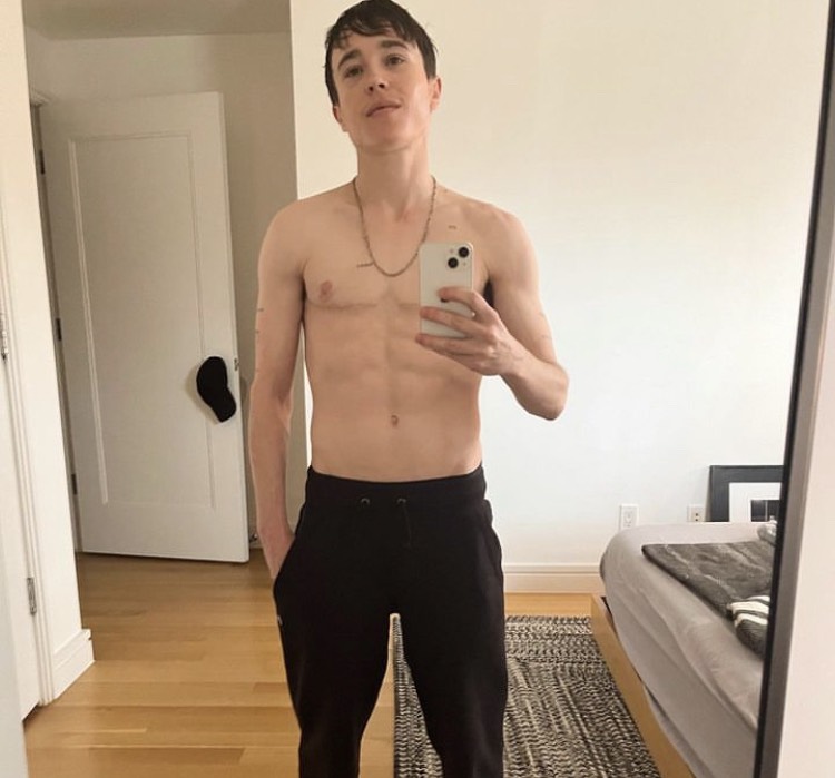 Cinsiyet Değiştirmişti! Son Hali Gündem Oldu...