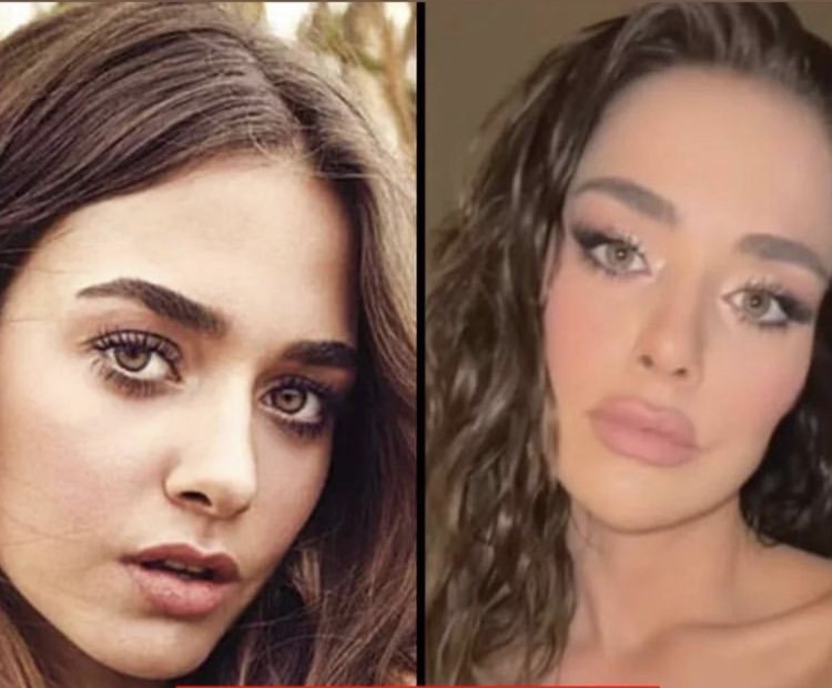 Tuzak&#039;ın Yıldızı Bensu Soral Hakkında Çarpıcı İddia!