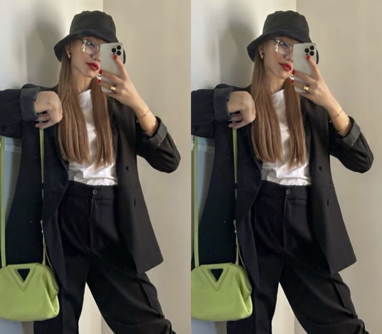 Cinsiyet Değiştiren Beren Güney&#039;in Son Hali Olay Oldu