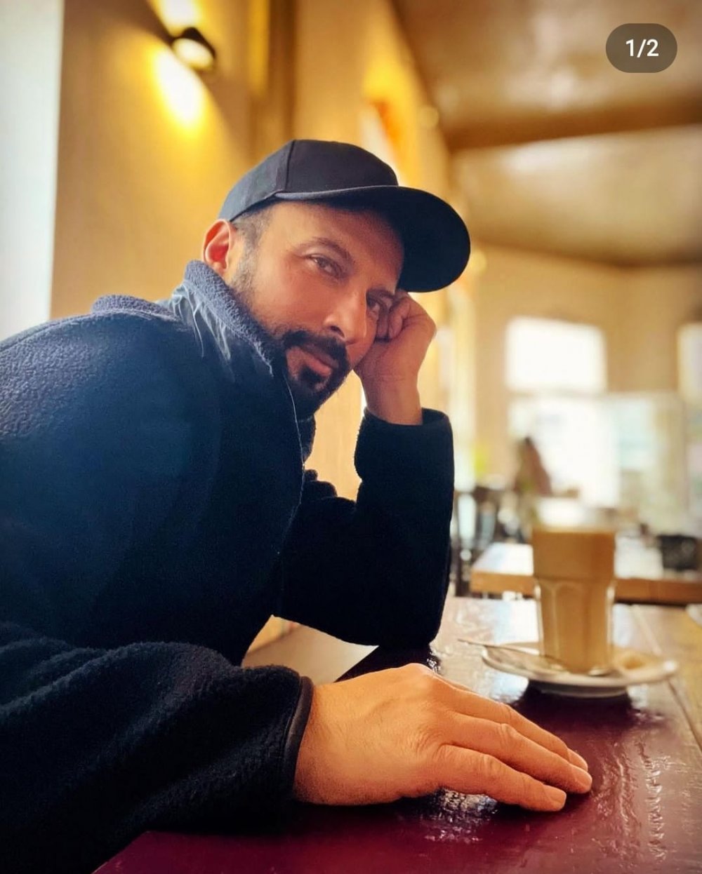 Tarkan'ın ellerine ne oldu?