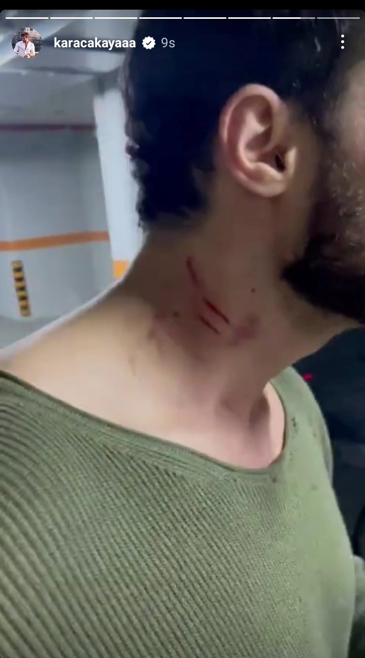 Batuhan Karacakaya ile Ayşe Aslanpay&#039;dan Şok Açıklamalar! Birbirlerinden Şiddet Gördüklerini İddia Edip Flaş Paylaşımlarda Bulundular