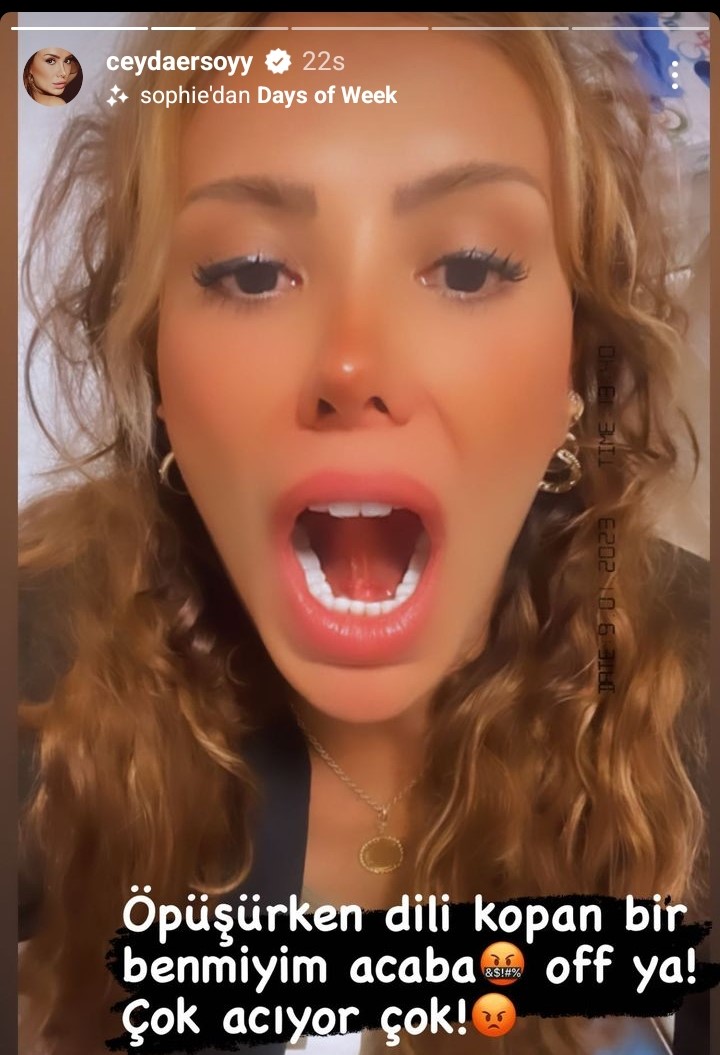 Ünlü İsmin Öpüşürken Dili Koptu