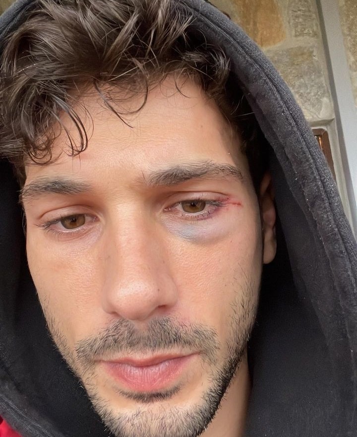 Talihsiz Kaza Sevenlerini Üzdü 