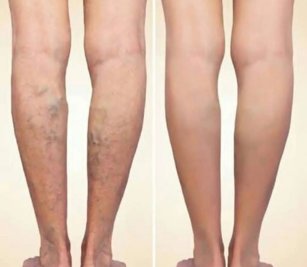 Varis Ne Zaman Tehlikelidir?